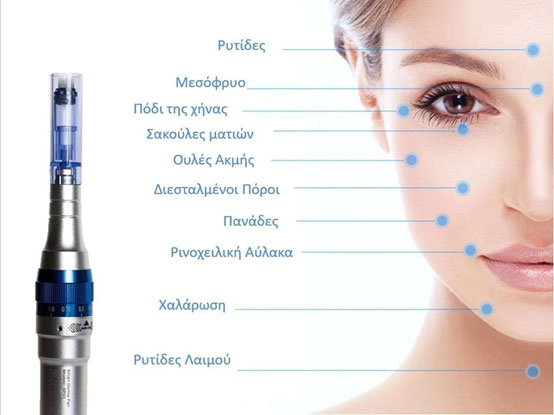 ΜΗ ΕΝΕΣΙΜΗ ΜΕΣΟΘΕΡΑΠΕΙΑ ΜΕ MICRONEEDLING