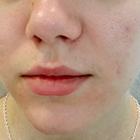 GREEN PEEL-DEEP PHYTOPEELING