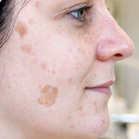 GREEN PEEL-DEEP PHYTOPEELING